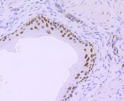 RNA Polymerase II/POLR2A (ac Ser5) Rabbit anti-Human, Mouse, Rat, Clone: